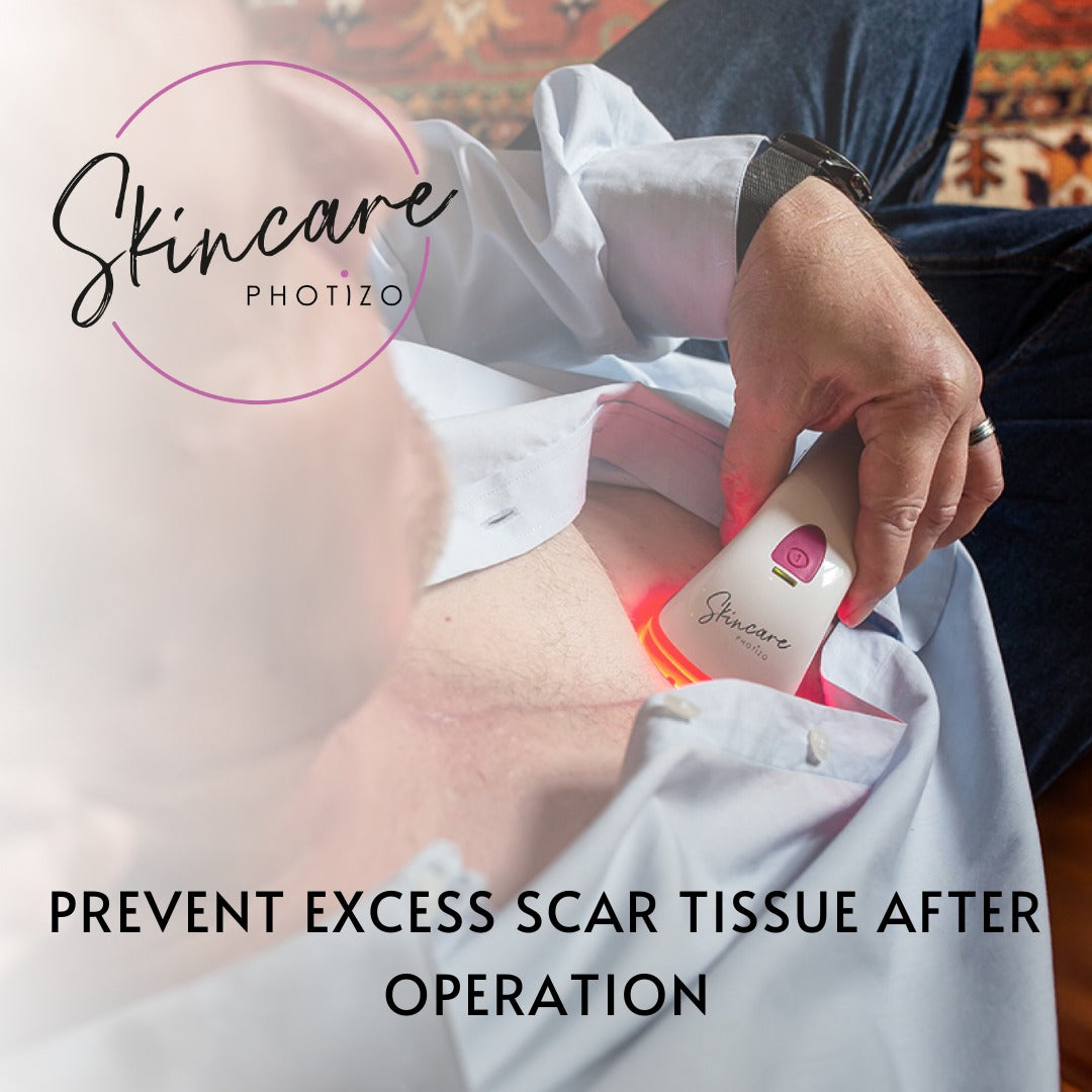 Photizo Skin Care LED-ljusterapi/LED-LLLT